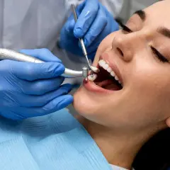 Dentysta zakłada plombę w zębie pacjentki.