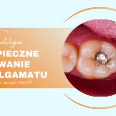 Bezpieczne usuwanie plomb amalgamatowych. Zbliżenie na zęby z widoczną starą plombą.