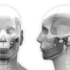 Anatomia czaszki z widokiem z przodu i z boku, uwzględniająca staw skroniowo-żuchwowy, kluczowy dla zastrzyków w staw skroniowo-żuchwowy.