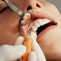 Dentysta bada zęby, widoczna jest duża dziura w zębie, która wymaga leczenia.