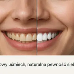 Porównanie uśmiechu: zęby żółte po lewej, białe po prawej. Czy cytryna wybiela zęby? Zdrowy uśmiech, naturalna pewność siebie.