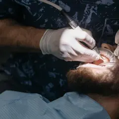 Dentysta w białych rękawiczkach używa wiertła i narzędzi, by oczyścić zęby pacjenta. To właśnie robi fleczer, co to za zabieg?