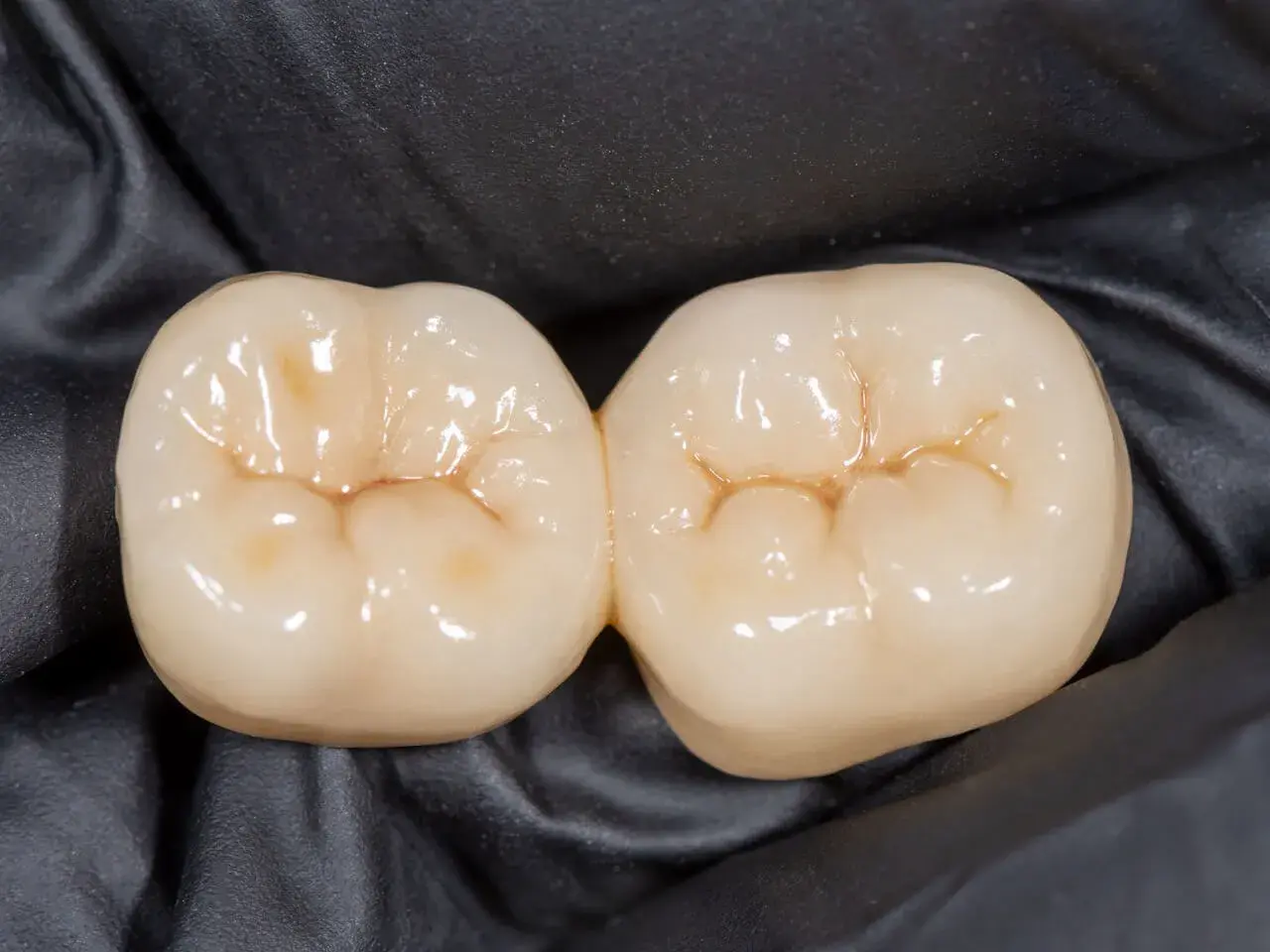Dwa połączone zęby ceramiczne z widocznymi bruzdami na zębach, gotowe do odbudowy uśmiechu.