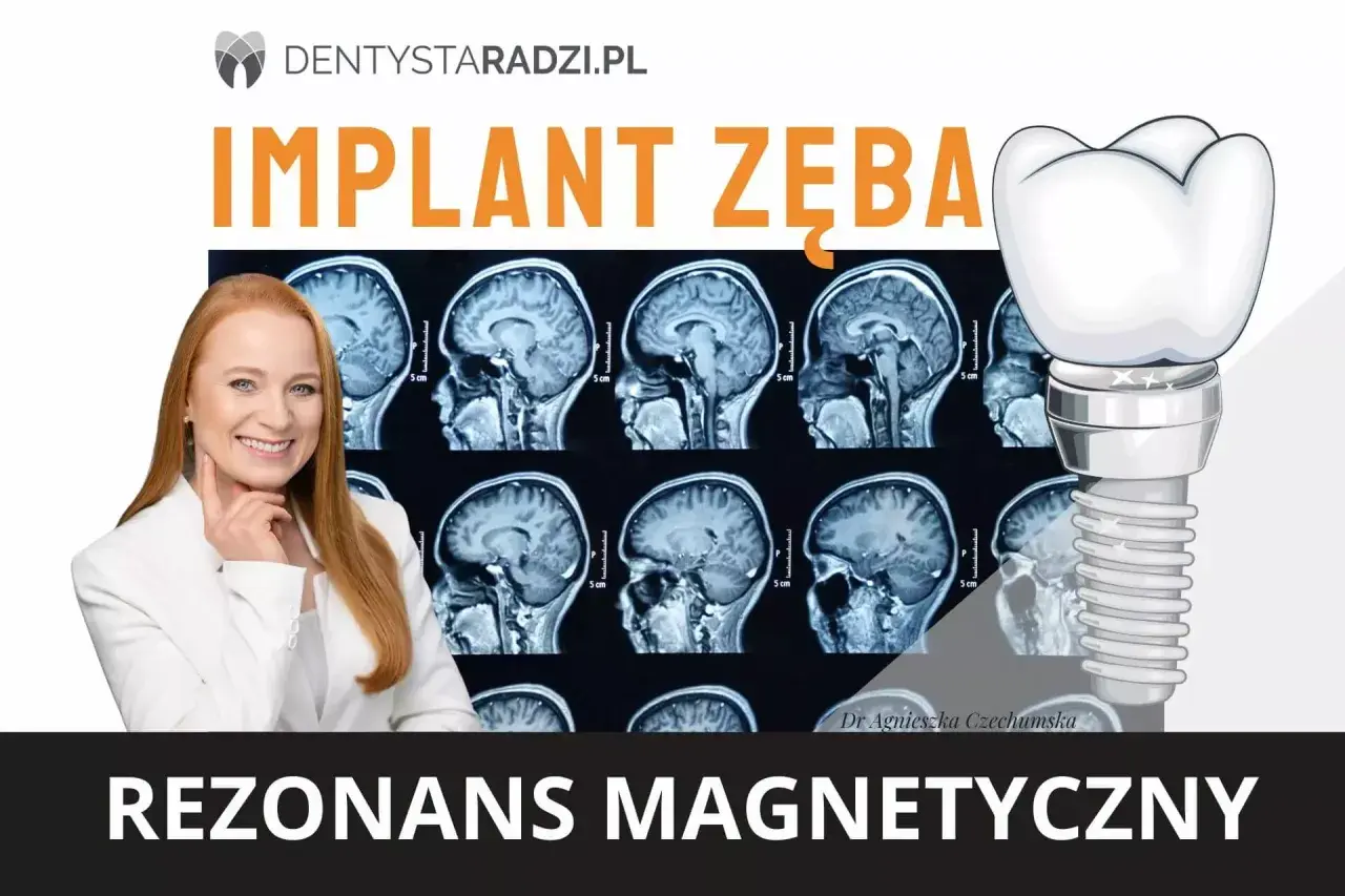 Rezonans magnetyczny a metal w zębie. Dr Agnieszka Czechumska wyjaśnia, czy implant zęba jest bezpieczny podczas rezonansu.
