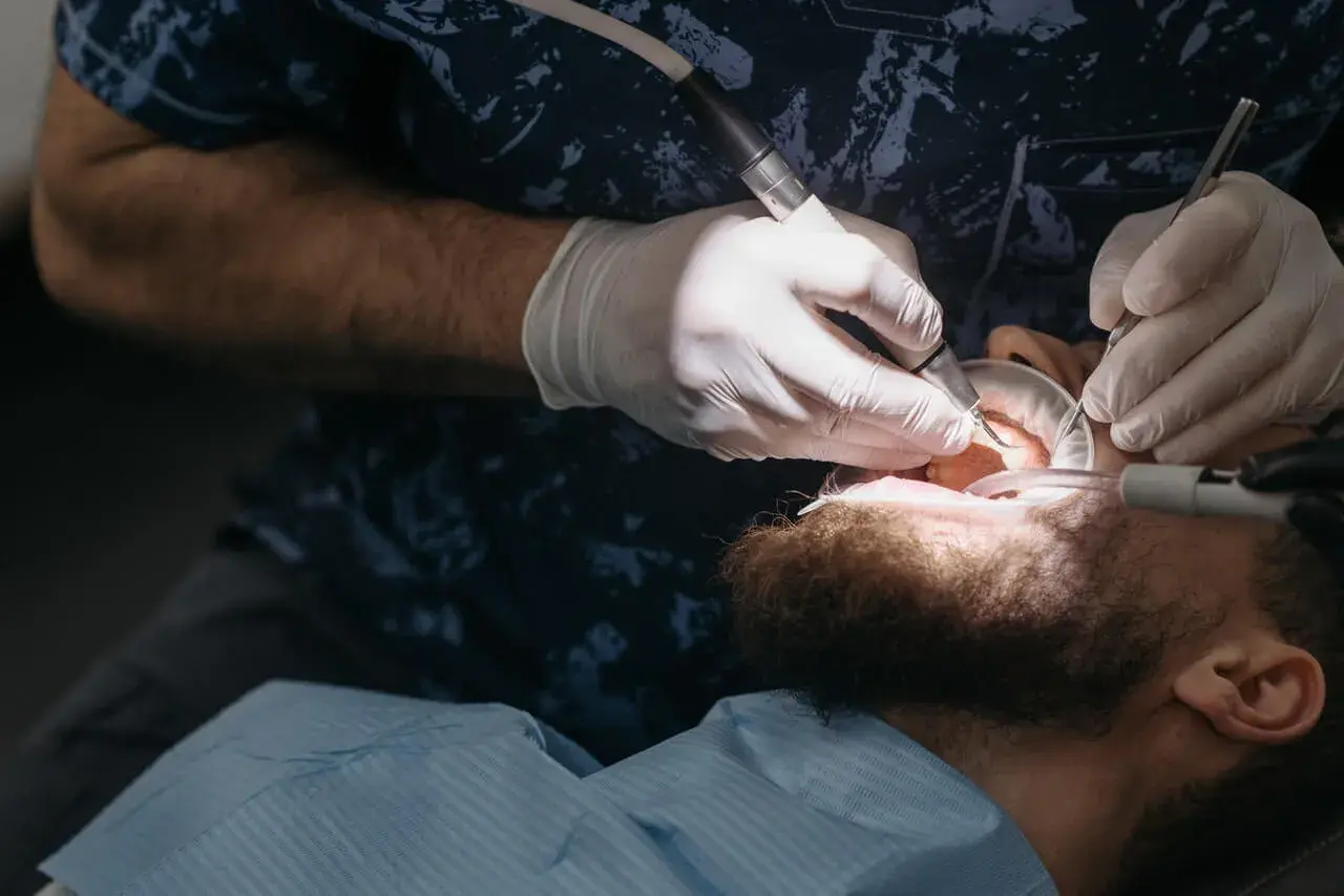Dentysta w białych rękawiczkach używa wiertła i narzędzi, by oczyścić zęby pacjenta. To właśnie robi fleczer, co to za zabieg?