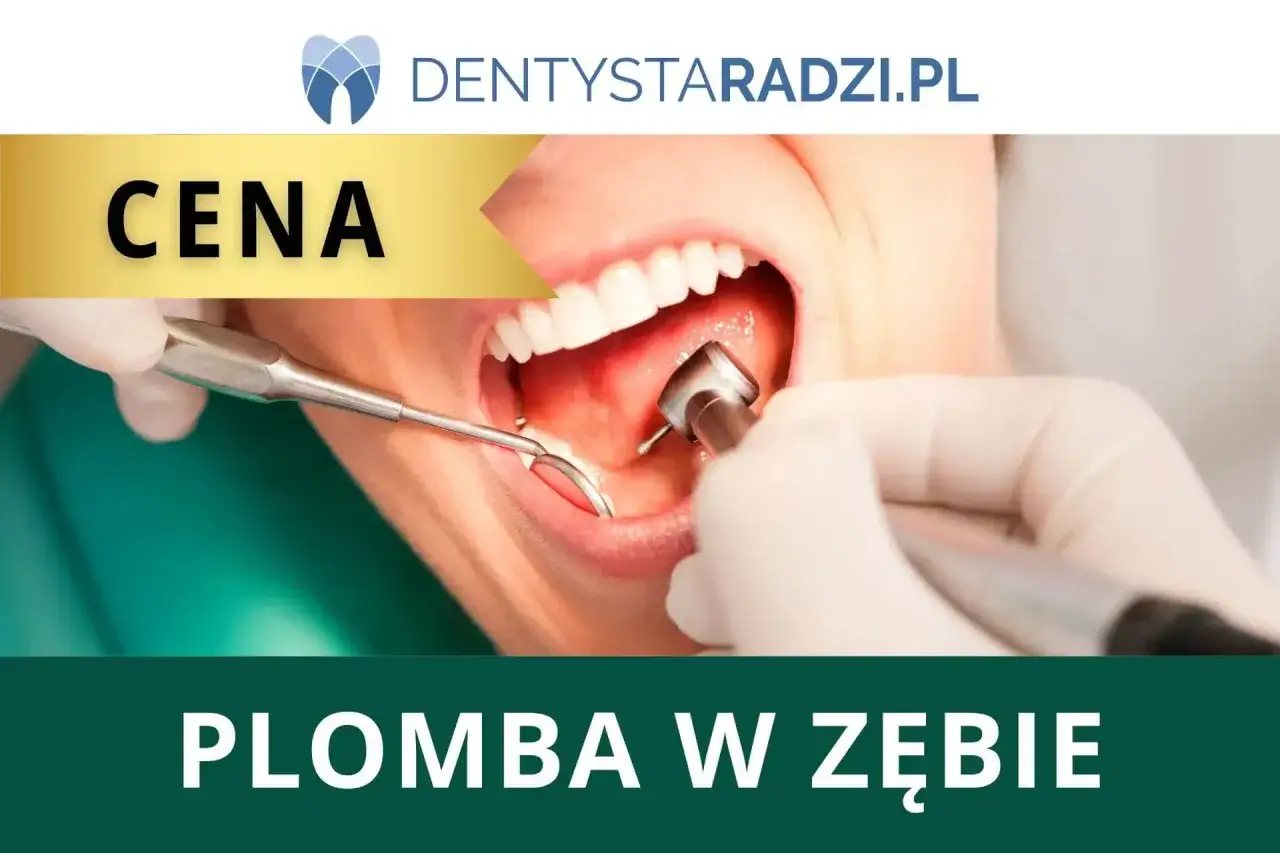 Dentysta zakłada plombę w zębie. Na zdjęciu widać narzędzia dentystyczne i otwarte usta pacjenta.