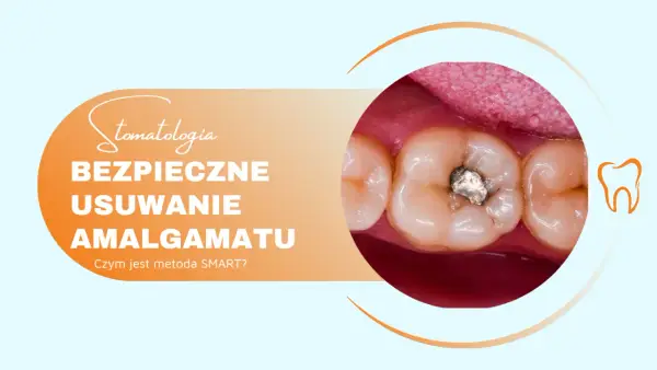 Bezpieczne usuwanie plomb amalgamatowych. Zbliżenie na zęby z widoczną starą plombą.